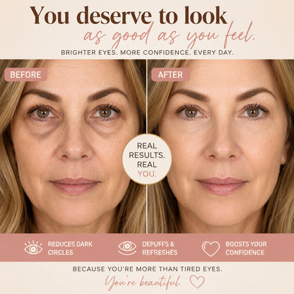 Close-up of tired eyes with dark circles and under-eye puffiness